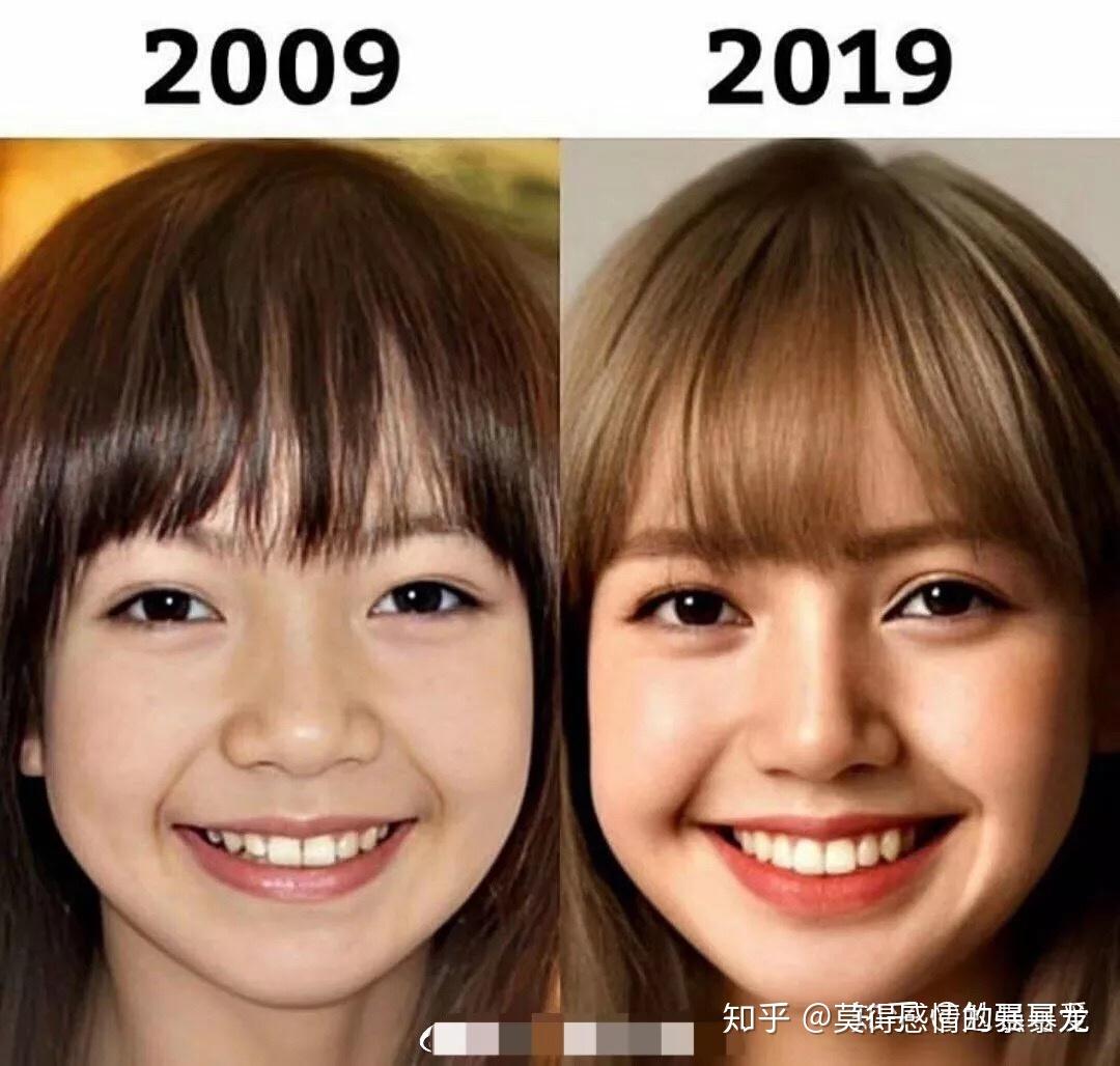 有人说blackpink的lisa动过鼻子,lisa到底有没有整容过? - 知乎