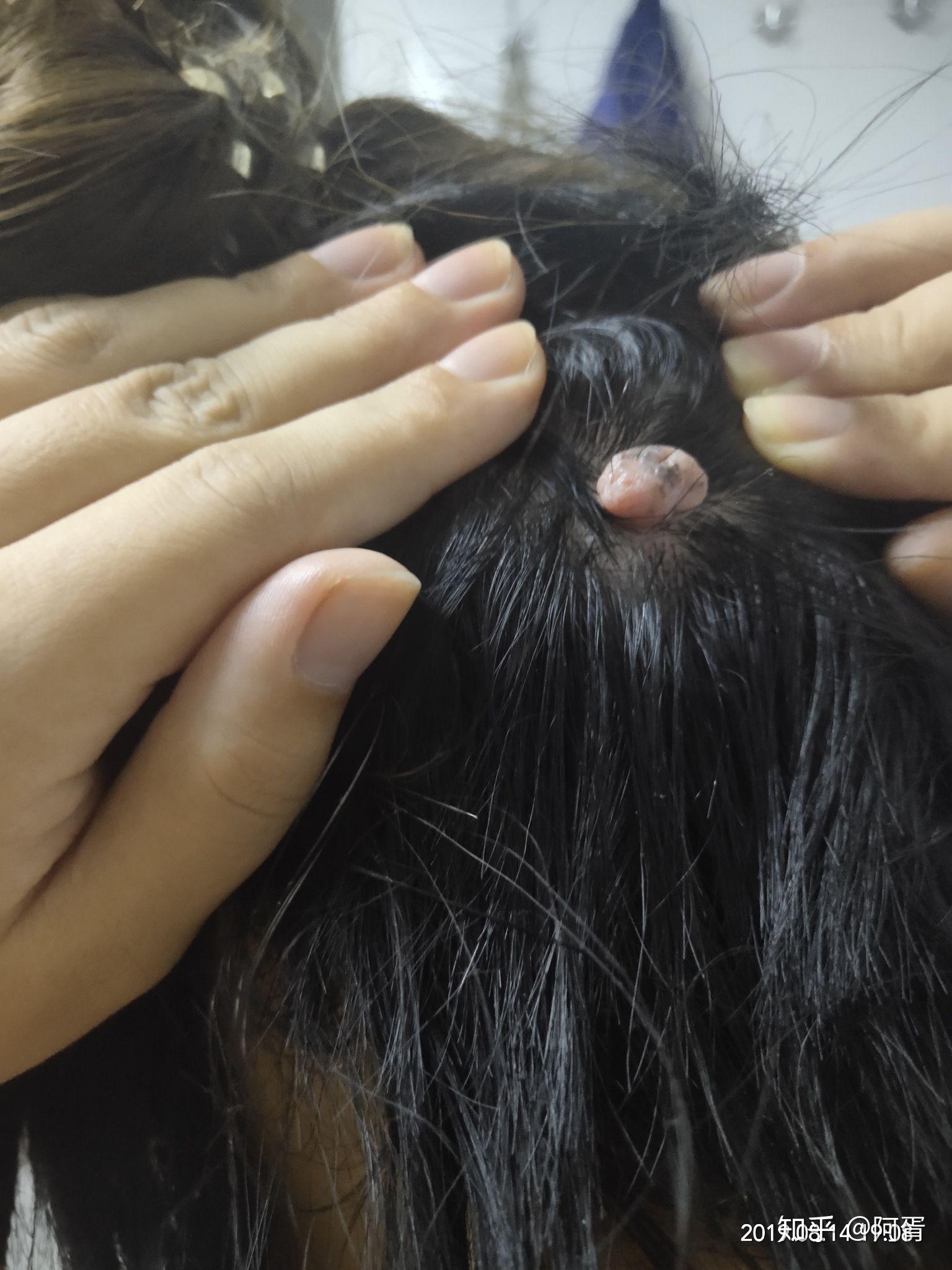 后脑勺长了一个肉疙瘩