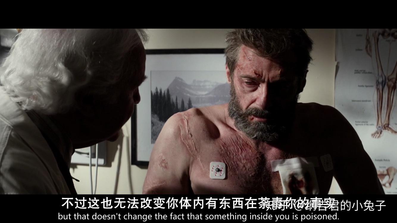 金刚狼3里狼叔为什么会死