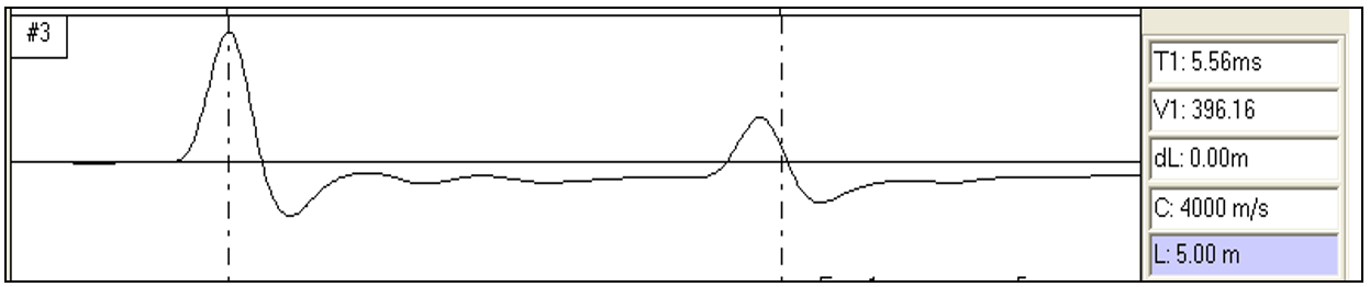 天天做低应变还不会看波形?