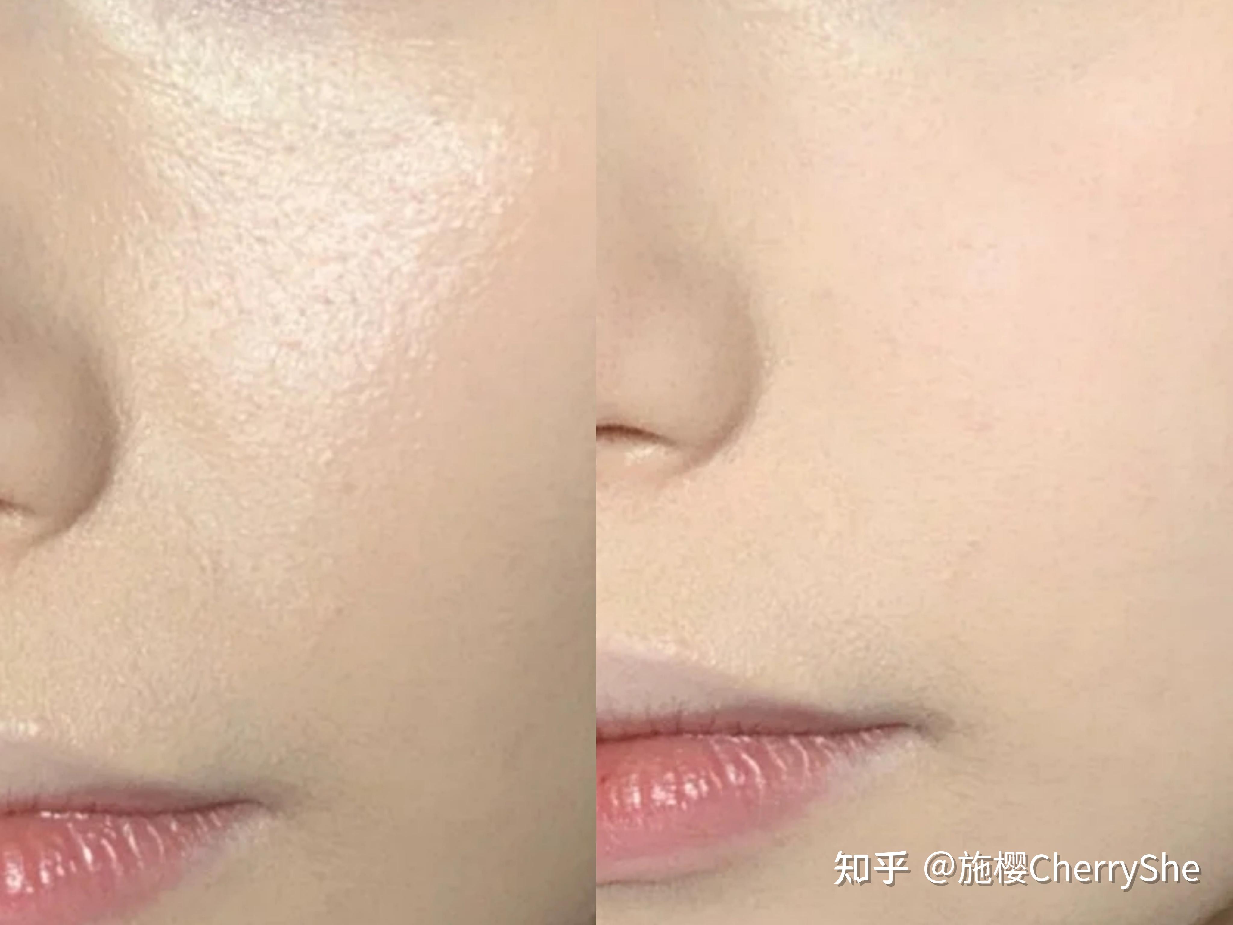 油皮痘肌适合哪款散粉