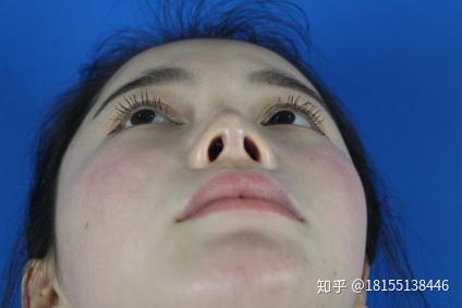 v2-86155bab16c86f577cf7bb4fbfca6af0_r.jpg