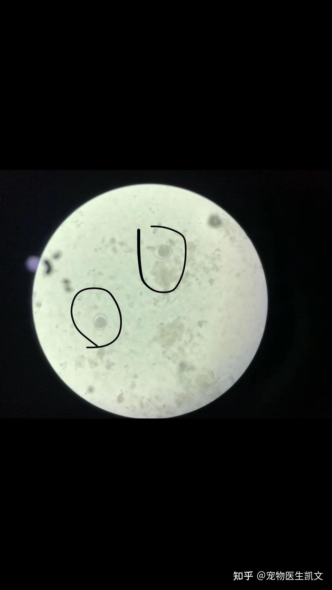 球虫 显微镜图片