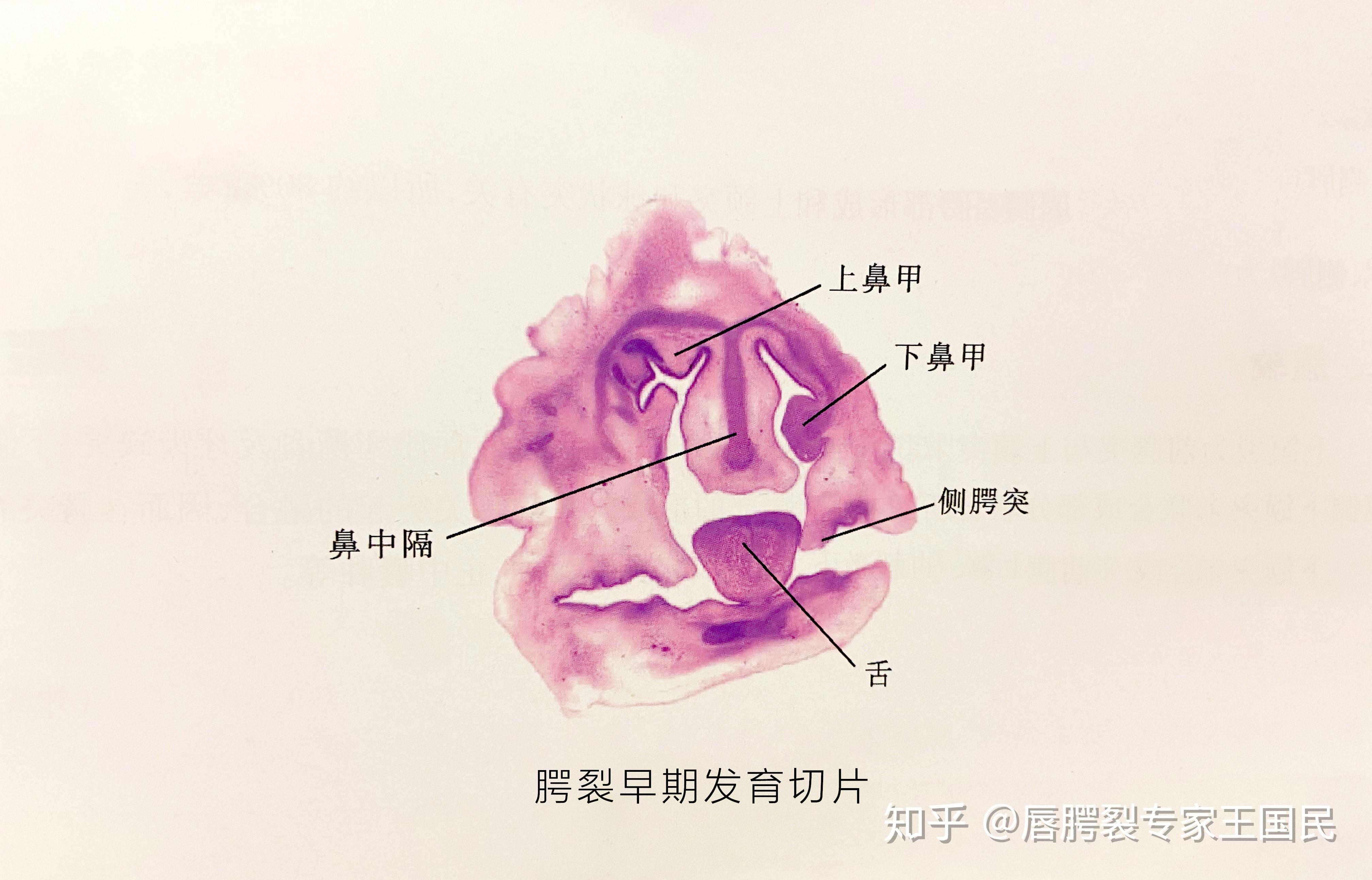 颌面部的胚胎发育之腭部的发育