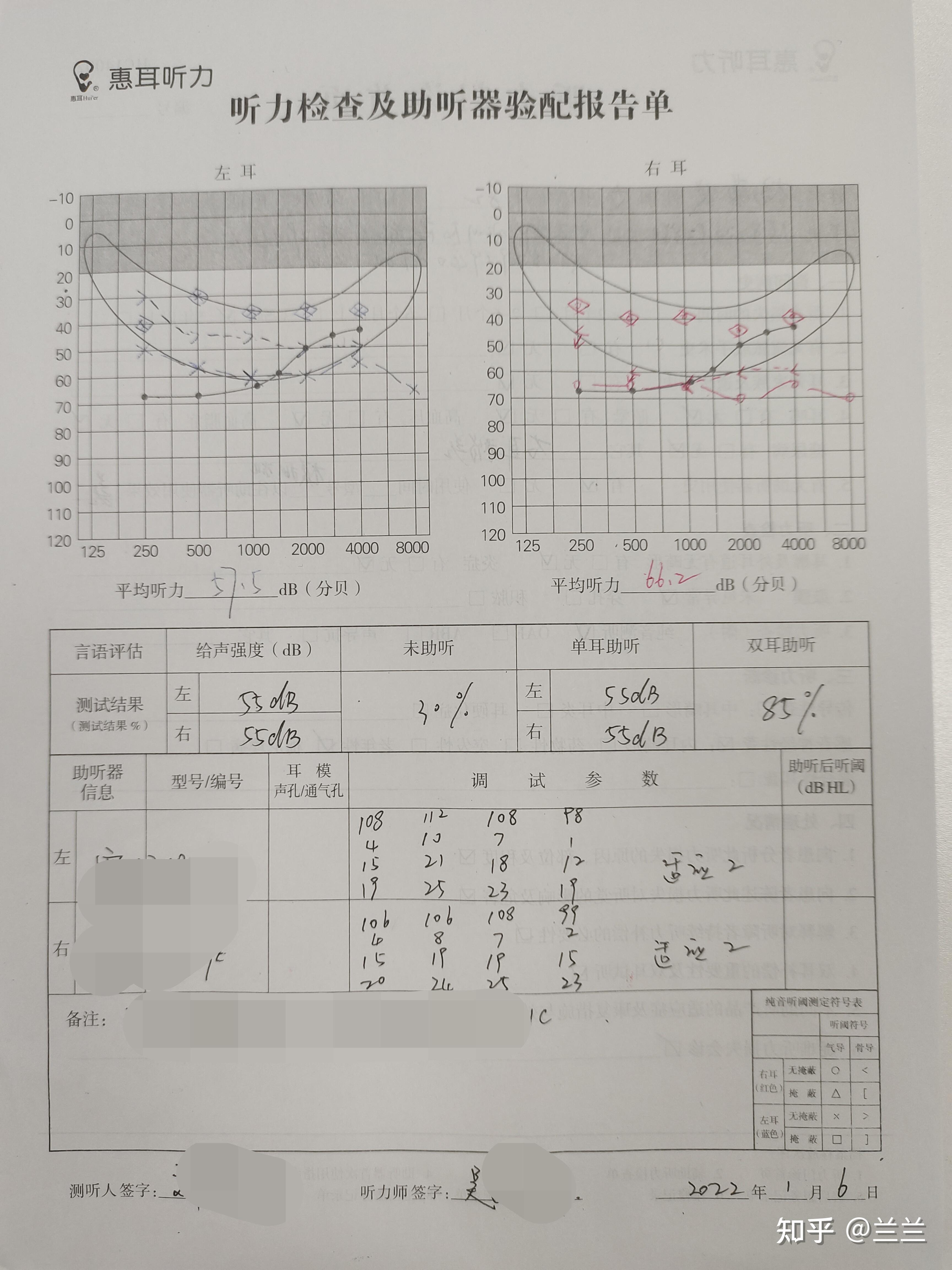 永川惠耳助听器:一位50岁的中年人是怎么保护残余听力?