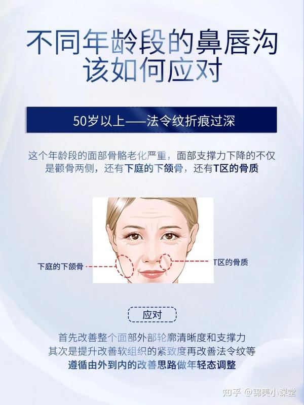 不同年龄段鼻唇沟如何处理？#医美科普# - 知乎