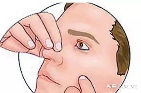 唐山五官医院:什么是鼻息肉?鼻息肉危害知多少? - 知乎