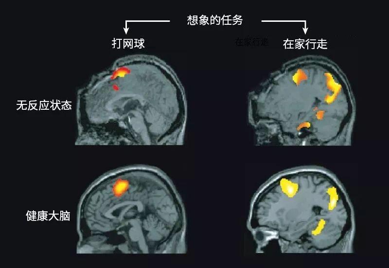 人类意识的起源和运作模式：意识调节或为疾病治疗提供新的可能 - 知乎