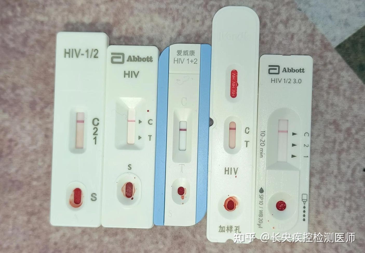 疾控中心检测hiv能做到100%准确吗?