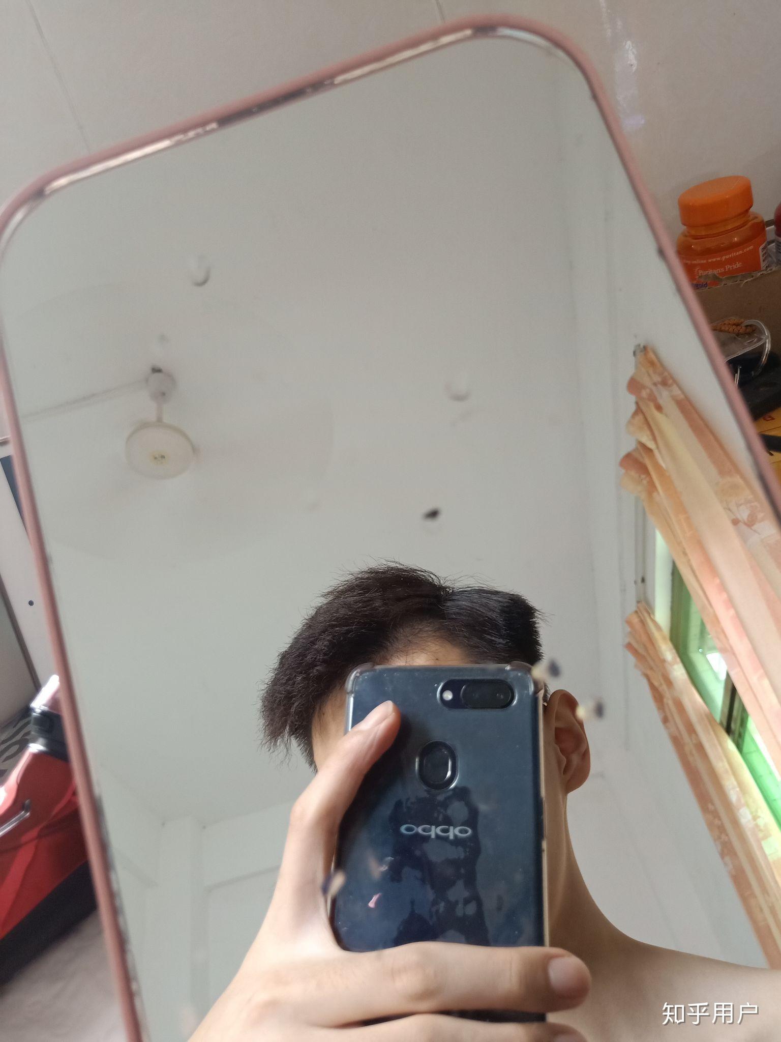 男生两侧头发稍微长点就翘起来头顶头发一长就朝前面趴下了总体发质较