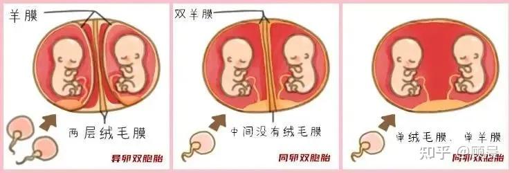 我想移两个胚胎,医生却建议我移植一个,成功率会不会降低? - 知乎