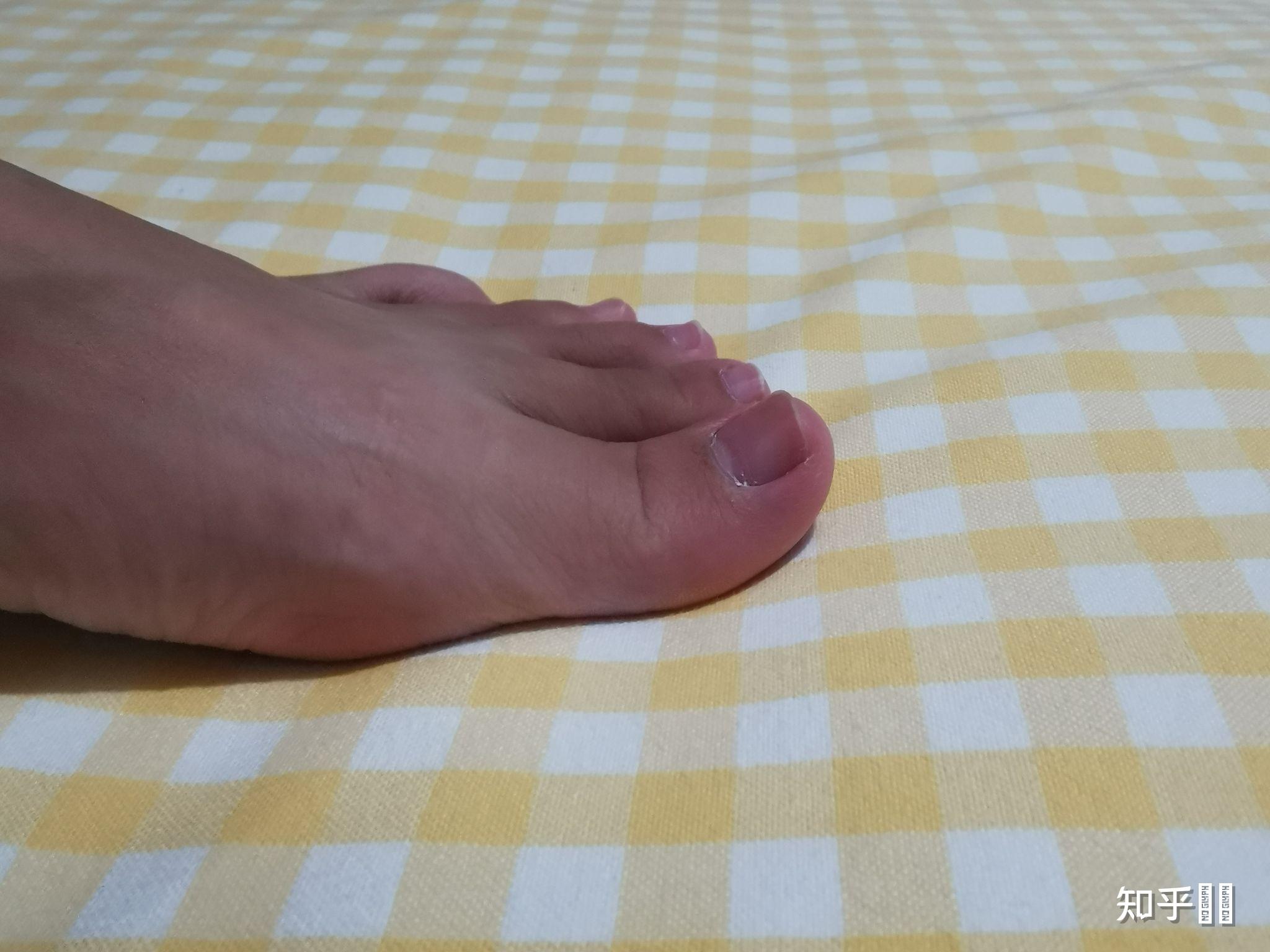 脚趾翘的人根本穿不了乐福鞋奶奶鞋大脚趾会被鞋面顶的非常疼为什么还