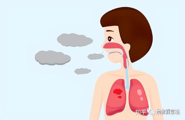 痰是什么?咽下去有事吗?怎么把嗓子里的痰弄出来? - 知乎