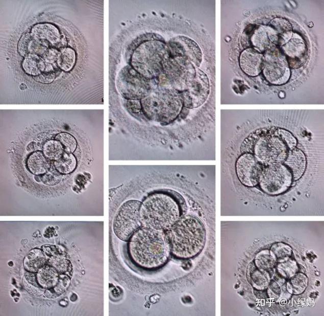 25岁宝妈,10枚胚胎中选择了一枚4aa胚胎,先生娃后创业!