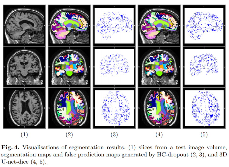 of 3d convolutional networks: brain parcellation as a pretext