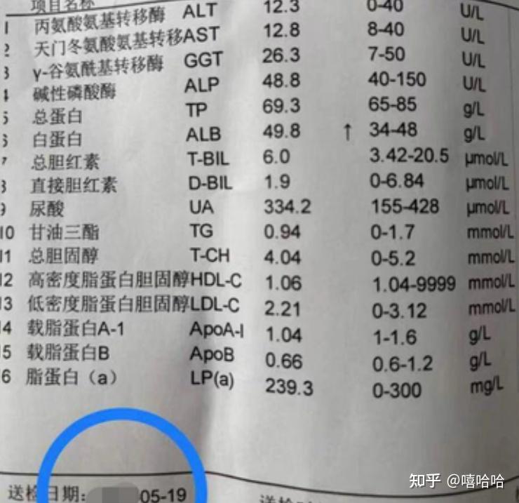 v2-87335a406bf195e436025d5c4c9f605a_r.jpg