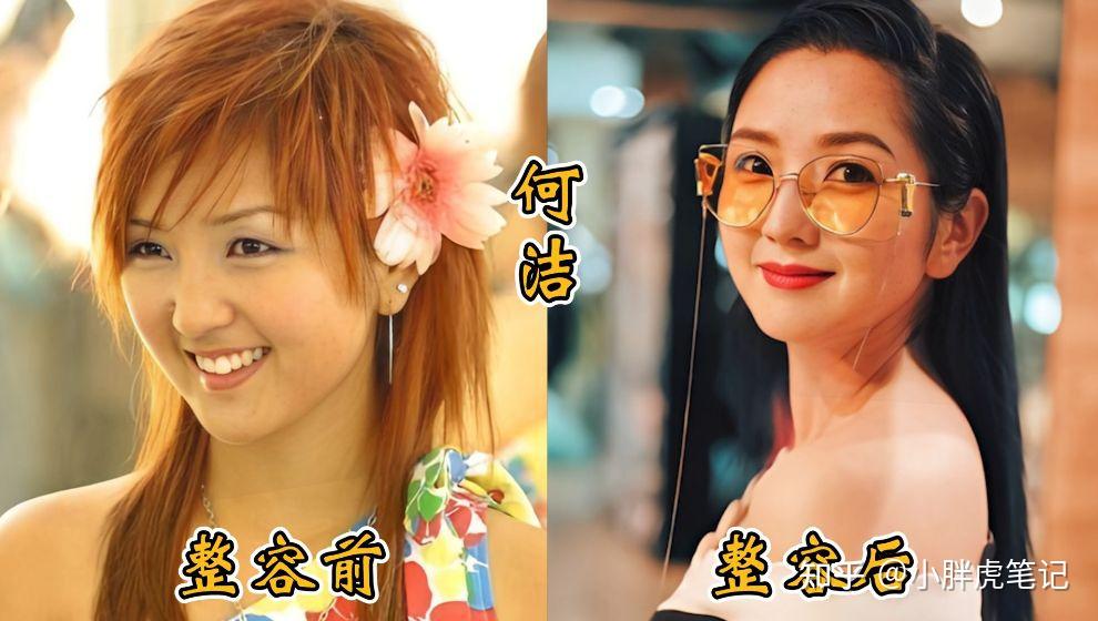 18位女明星整容前后对比，邵音音面目全非，杨颖堪称整容模板！ - 知乎
