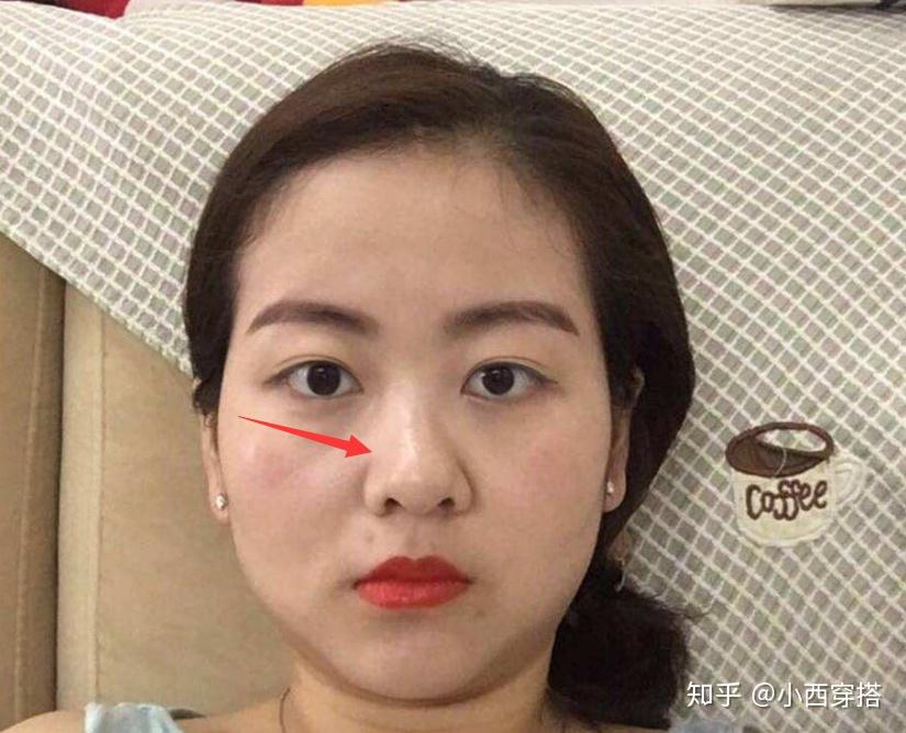 丑鼻子真的很降低颜值公认的5种丑鼻子真心希望你不是