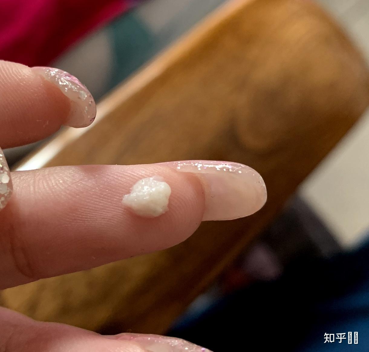 人的鼻屎能大到什么程度