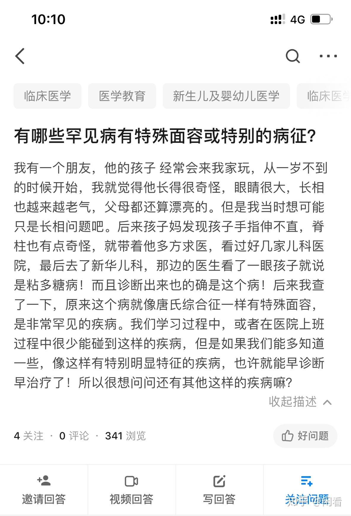 有哪些罕见病有特殊面容或特别的病征