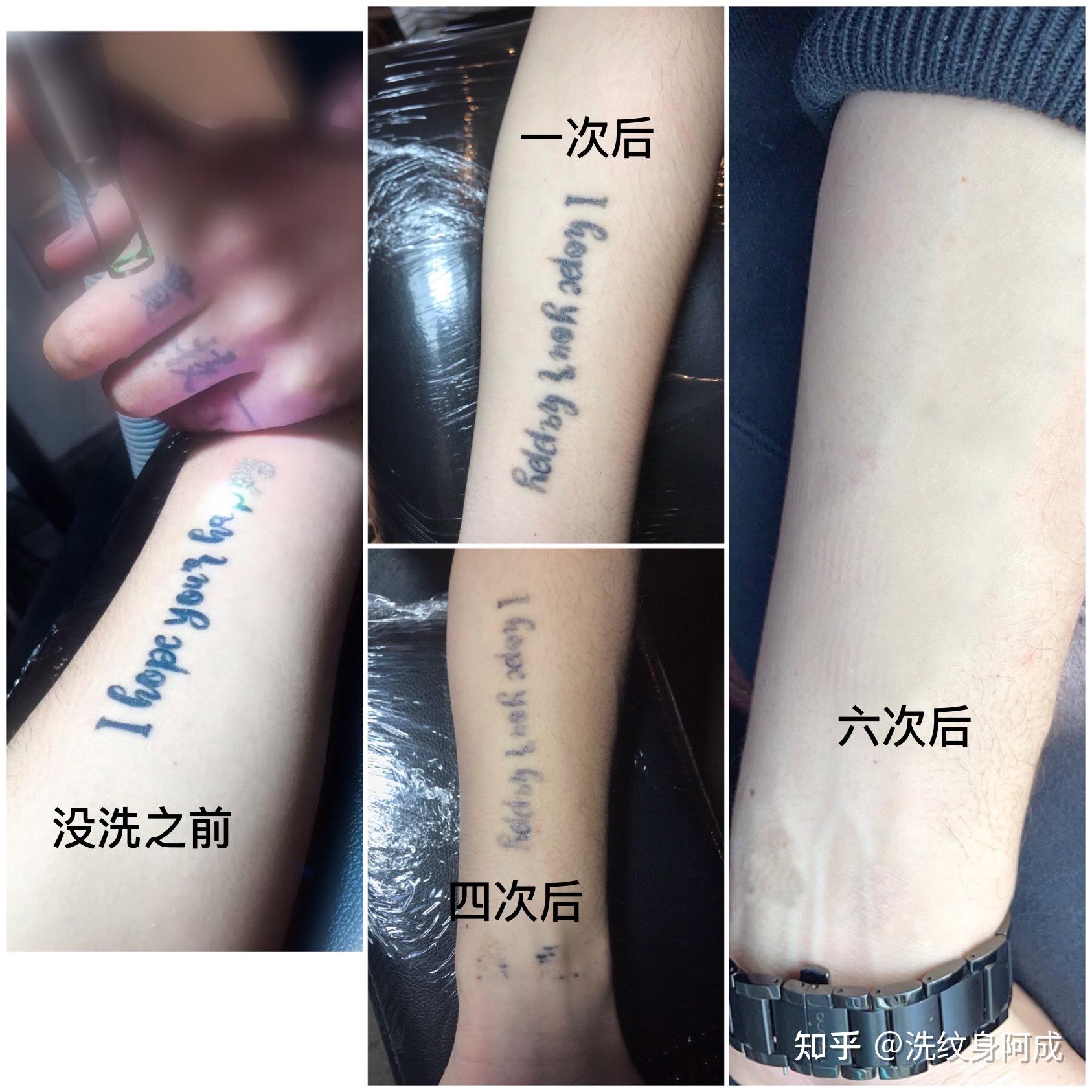 纹身清洗