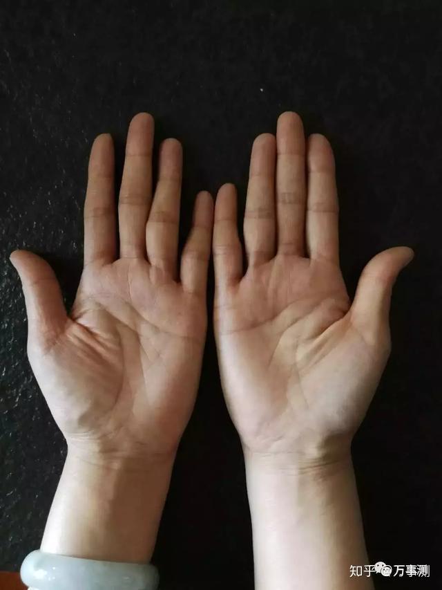 通过看掌形即知自身健康状态让您远离疾病
