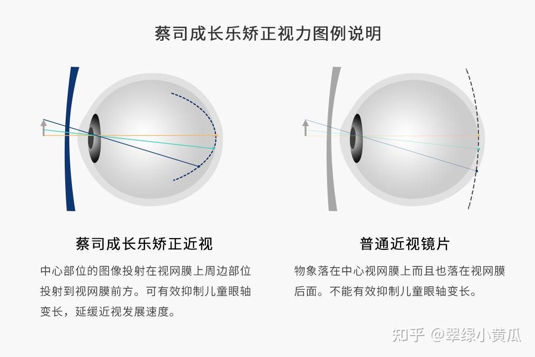 v2-878ff83b7be328cb93914171ece86460_r.jpg