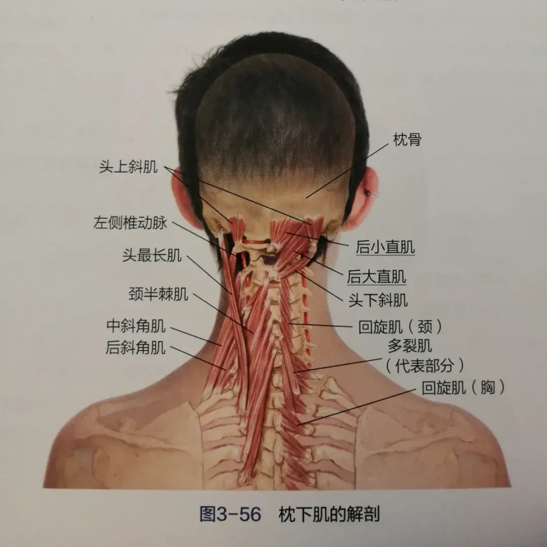 头痛,颈后僵硬,教您3步放松枕下肌群!