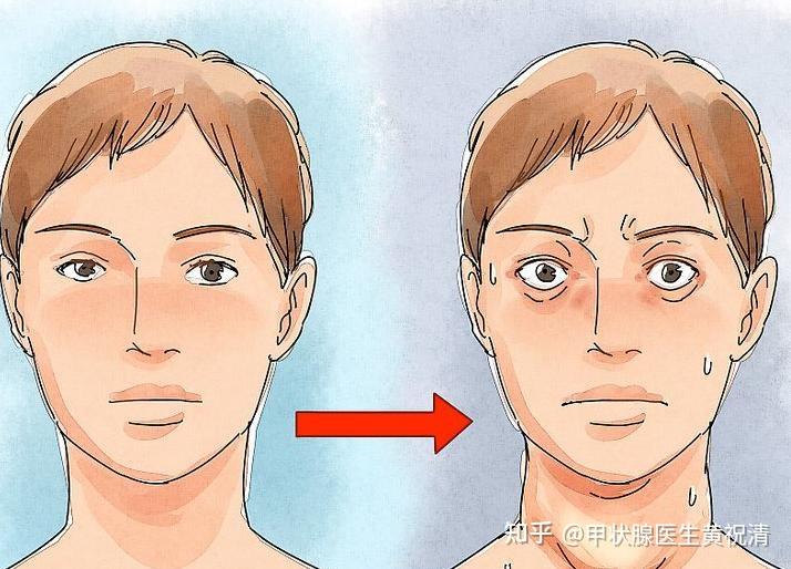 眼睛畏光、流泪、有异物感？注意！你可能是患上了这种疾病！ - 知乎
