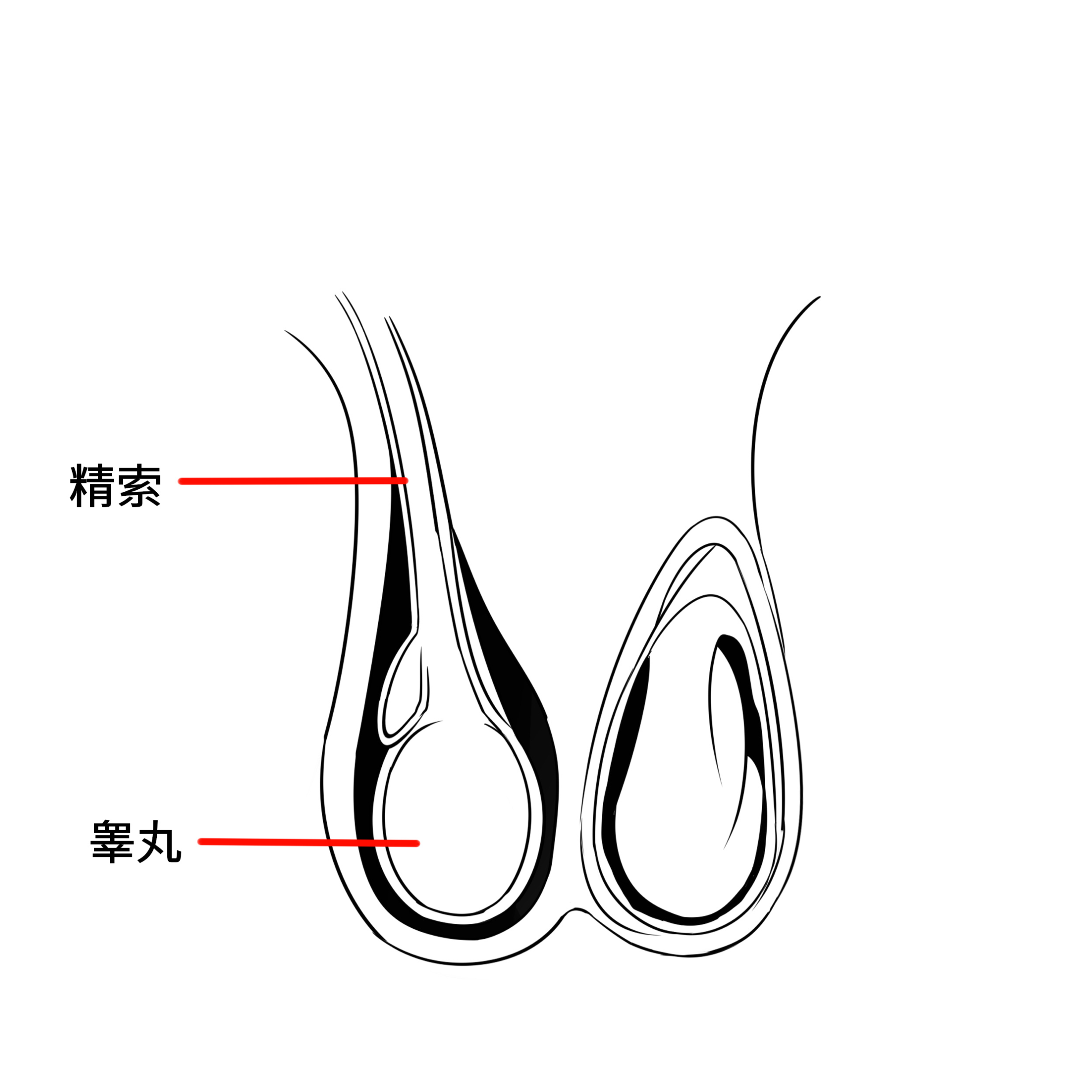 普通人到底要不要擔心睪丸扭轉