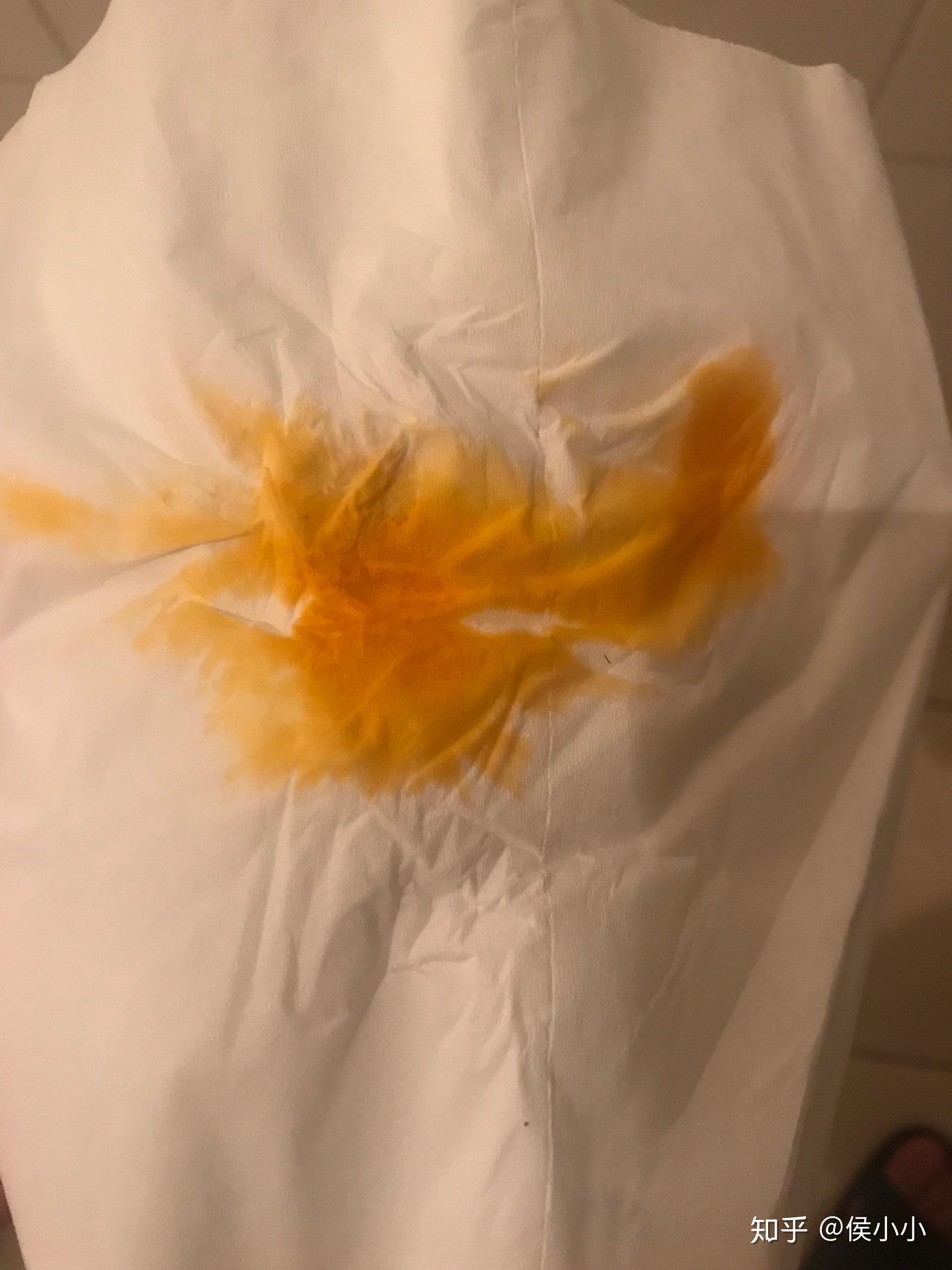 吃了油鱼(棘鳞蛇鲭)后屁股流油是一种什么体验?