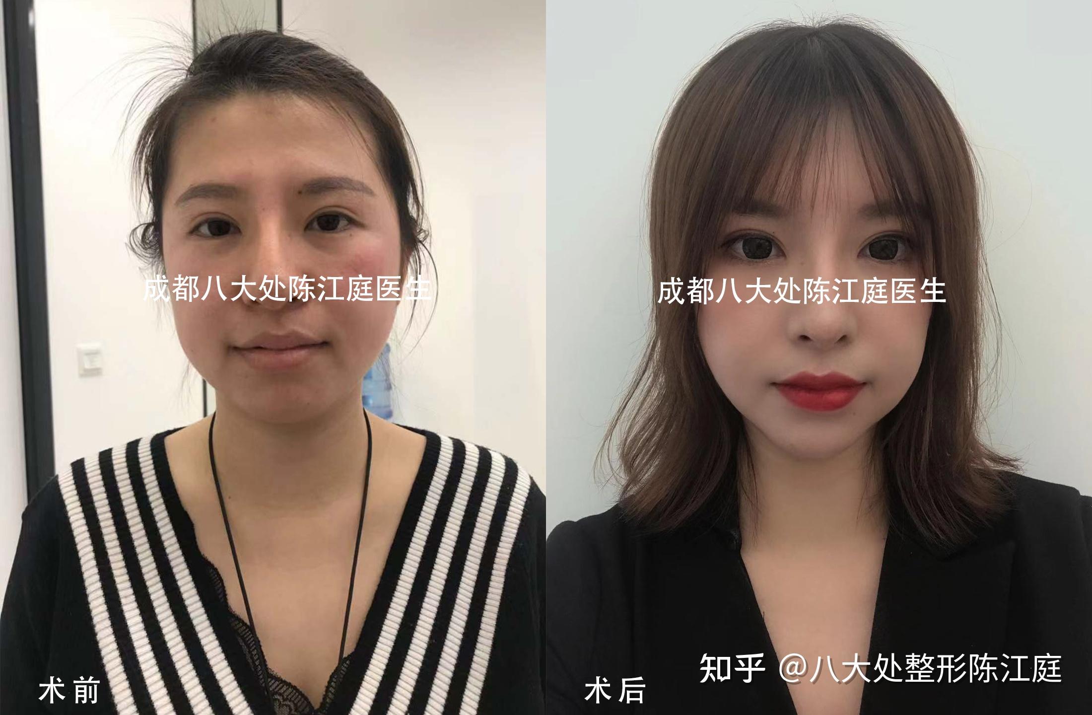 如何将面部初老“扼杀”在摇篮中？【点击文章揭晓答案】 - 知乎