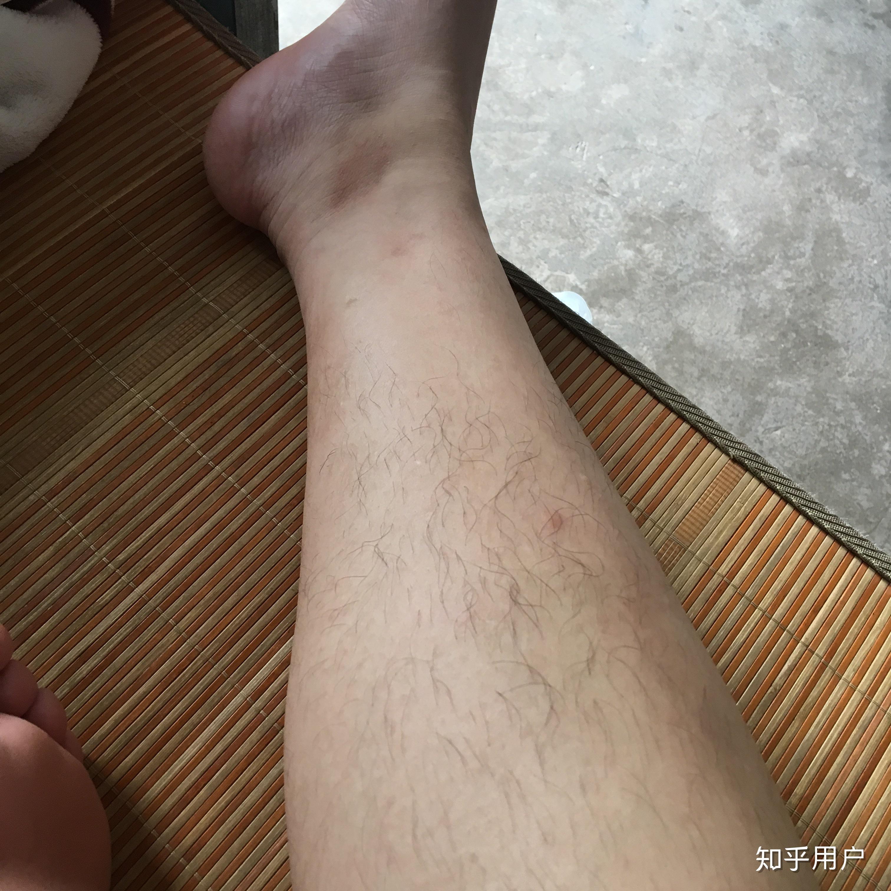 女生腿毛旺盛是怎样的人生体验