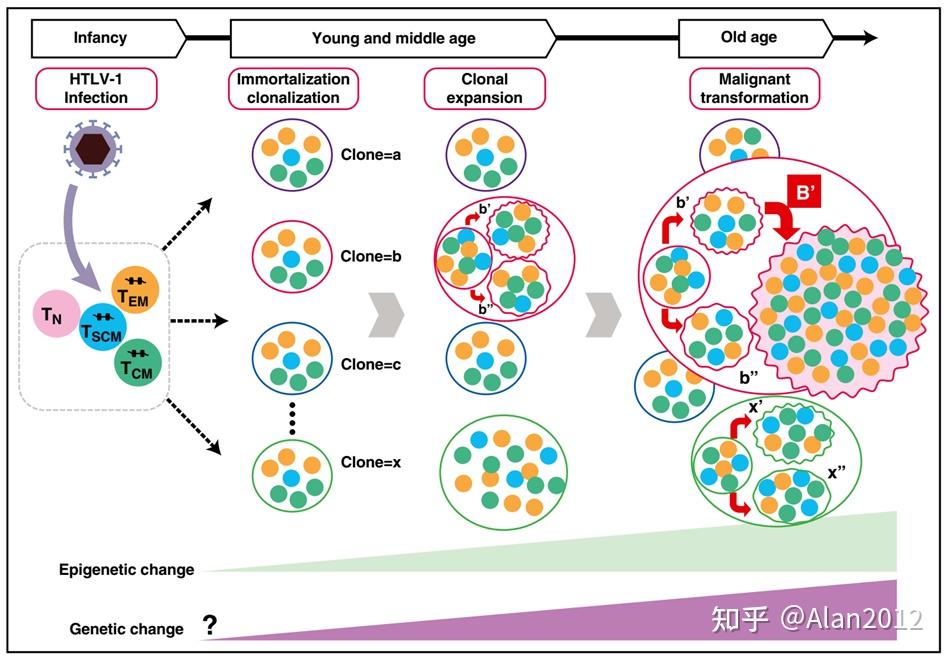 成人T细胞白血病(Adult Tcell leukemia,ATL) 知乎