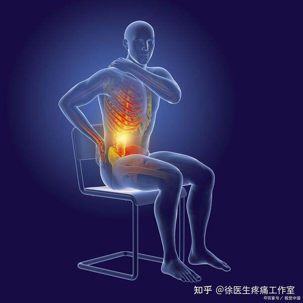 7种常见下背痛位置与原因，教你如何鉴别诊断！ - 知乎