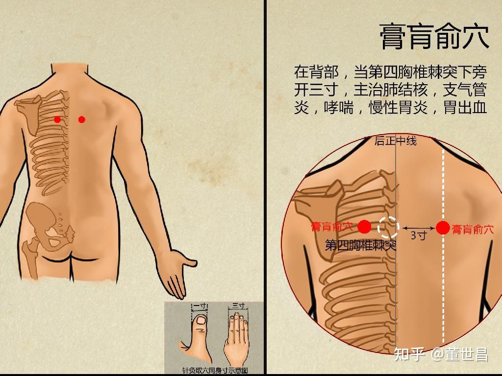 膏盲准确位置图和功效图片