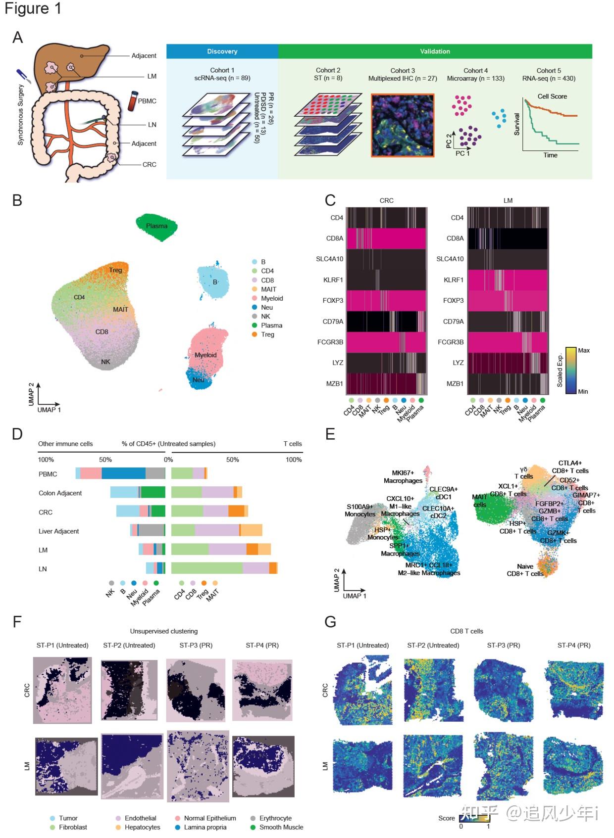 10x单细胞空间联合分析解析结肠癌肝转移时空免疫图谱 知乎 0129