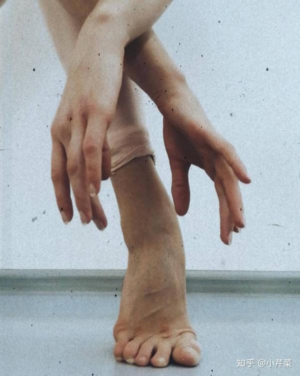 舞蹈生的脚变形图片