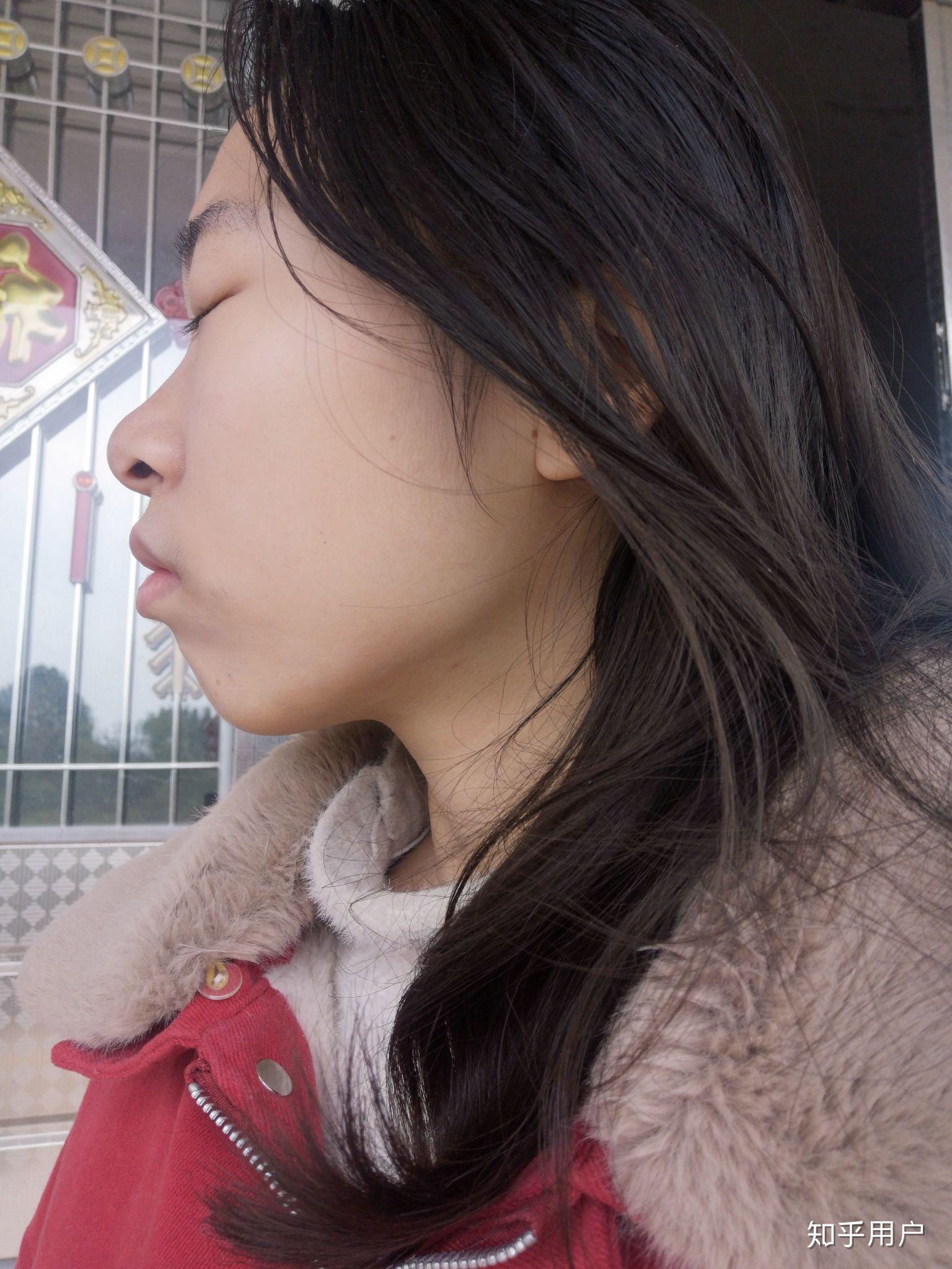 女生侧脸不好看怎么办?