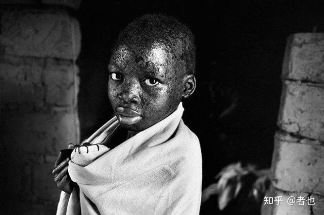 老照片实拍坦桑尼亚的艾滋病人记录生命的最后一程