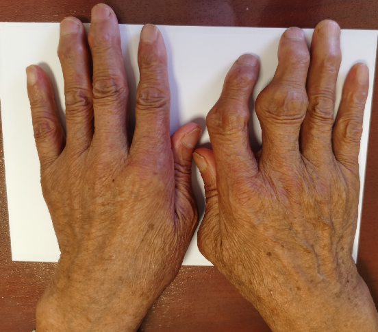 沧桑的老母亲的手