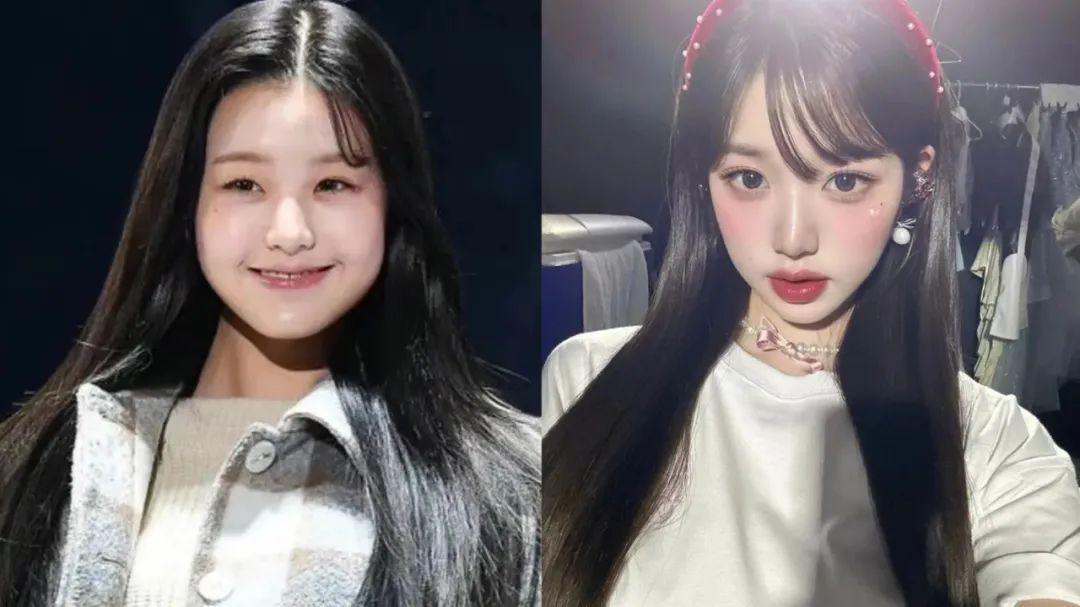 变化最明显的,一是双眼皮宽了,二是嘴唇厚了,三是脸型轮廓紧致照.