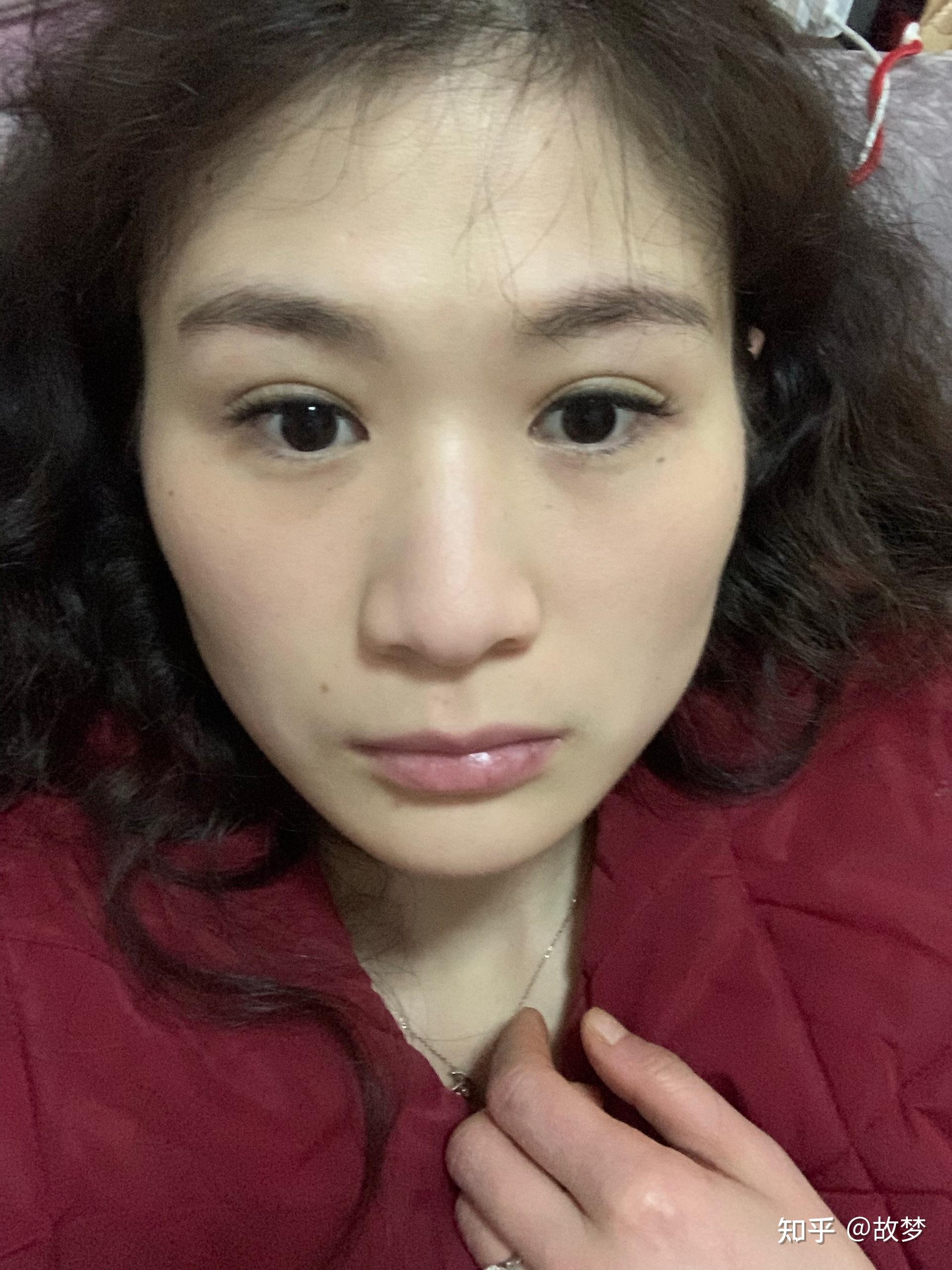 颧骨一高一低后天除手术外如何改善