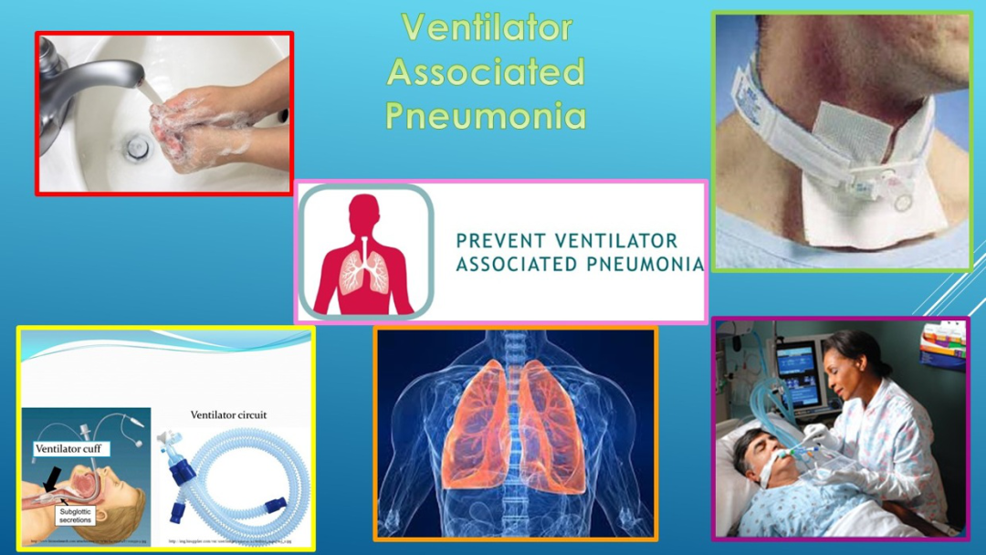 acute pulmonary edema图片