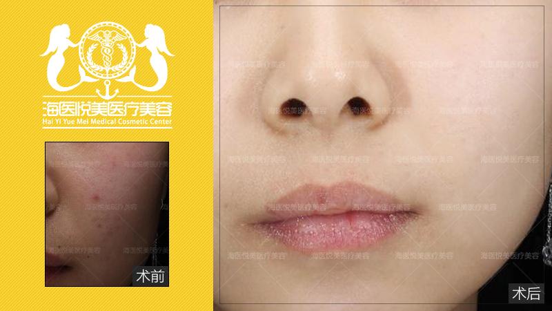 v2-89c156cff2289415fe91505d94c552c0_1440w.jpg?source=172ae18b