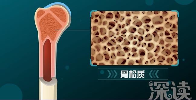 骨皮质松质骨示意图图片