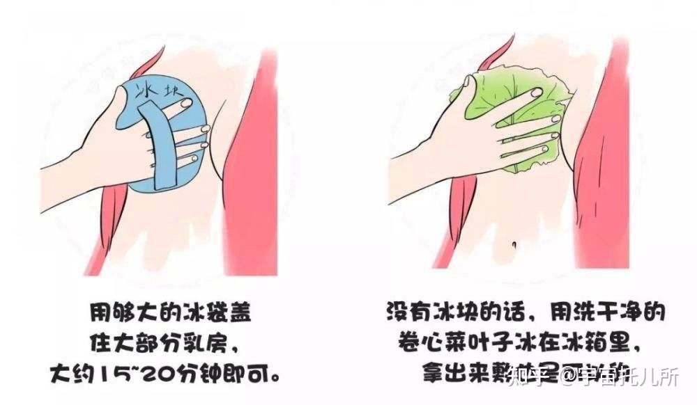 怎样科学回奶回奶的时候如果有硬块可以挤出来吗希望专