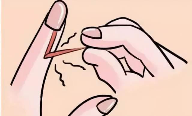 邓萃雯因拔倒刺入院如何无痛安全地拔倒刺