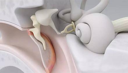 耳声发射oae是什么