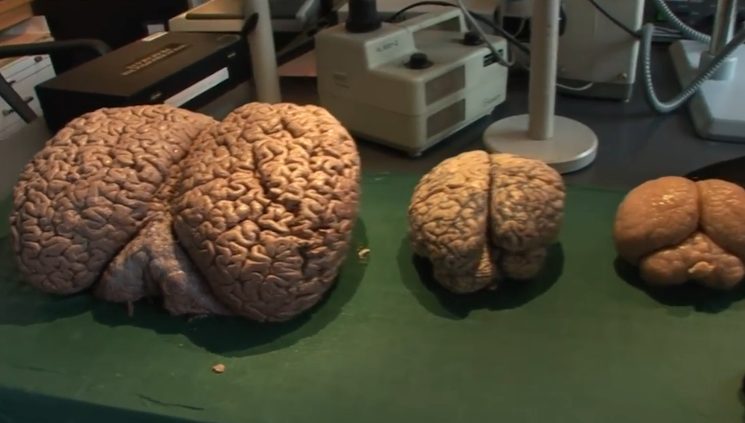 其头内还有一种非常重要的物质——鲸脑油,捕鲸人捕杀抹香鲸大多数就